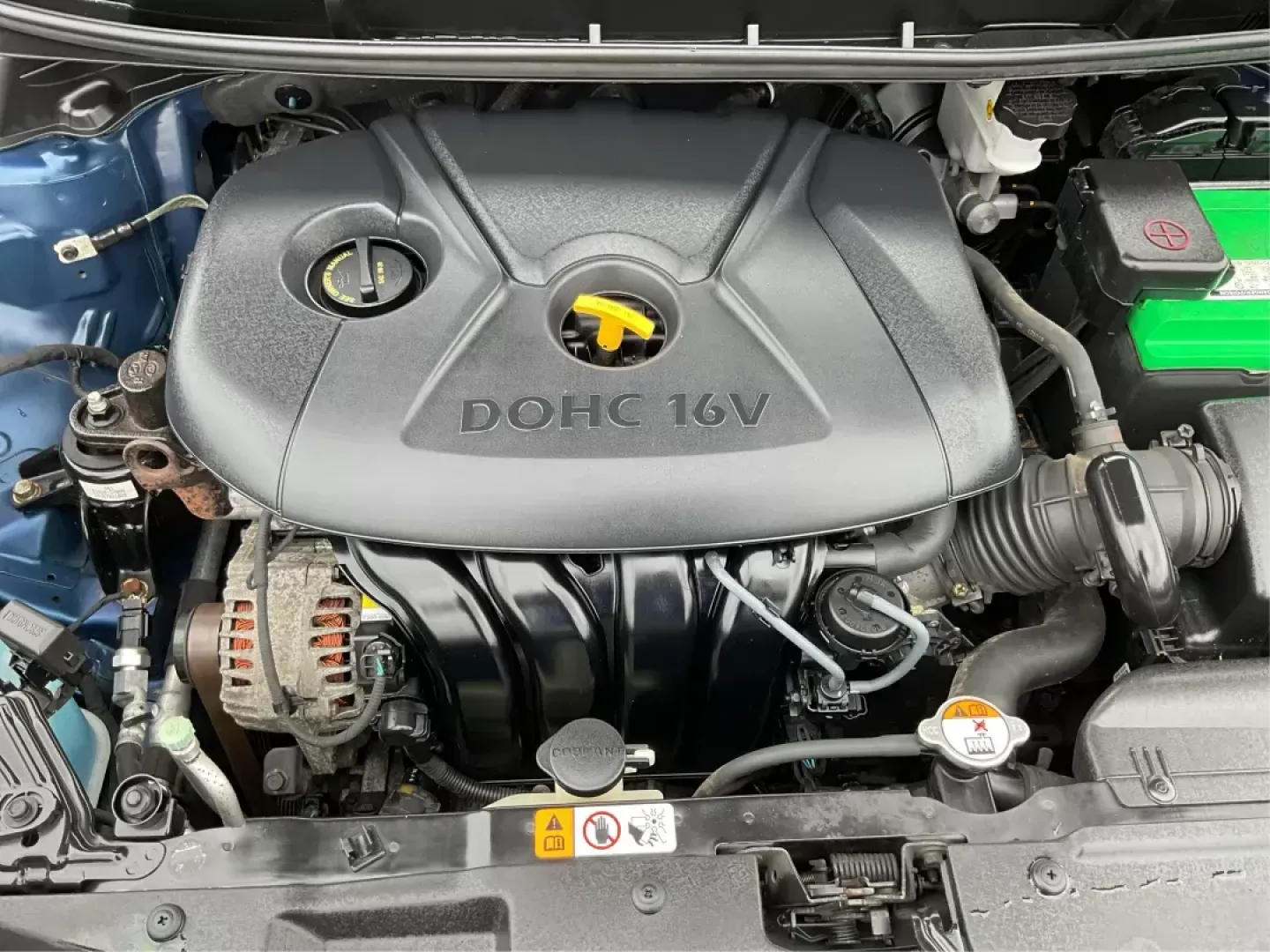 2013 Hyundai Elantra GT Base (KMHD35LE4DU) with an Other engine, located at 4508 South Dixie Dr, Moraine, OH, 45439, (937) 908-9800, 39.689976, -84.218452 - ### Discover Your Next Adventure with the 2013 Hyundai Elantra GT at Advantage Car and Credit!<br /> <br /> Are you looking for a reliable vehicle that enhances your daily commute and weekend getaways? Look no further than the 2013 Hyundai Elantra GT, available now at Advantage Car and Credit in Fai - Photo#10